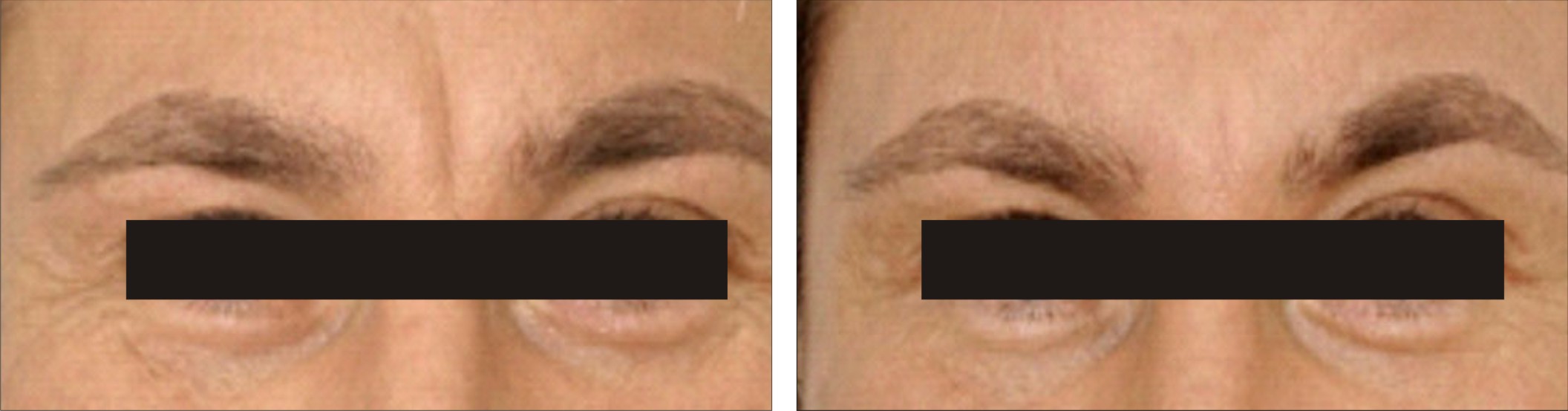 Anti Ageing Treatment Image One